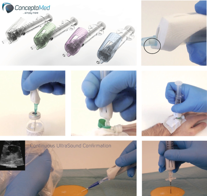 Britisk patent godkjent for Luer-Jack?